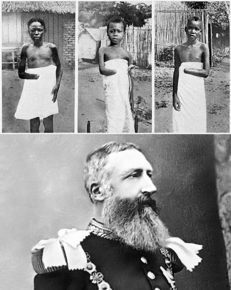 Belgia kuningas Leopold II valitses Kongot pikki aastaid, kui oma eraomandit